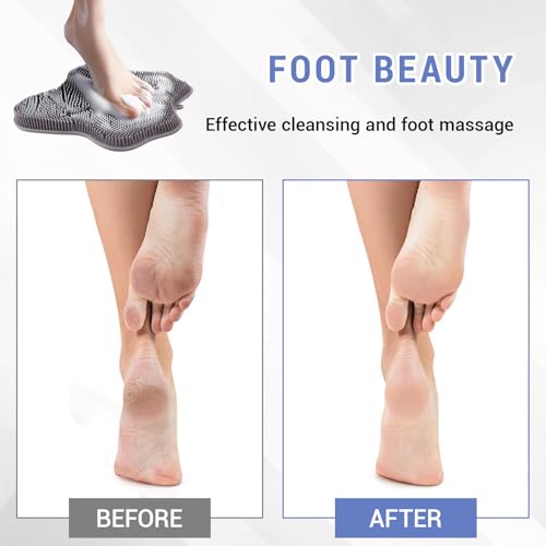 Silicone Foot Scrubber Mat for Shower Bath Foot and Back, Shower Feet Brush Pad with Wall-Mounted Suction Cups - color: Grizzly
