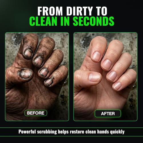 Grip Clean Nail Brush for Cleaning Fingernails – Heavy Duty Nail Brush with Extra Stiff Bristles - Fingernail Brush & Nail Scrubber Brush with Suction Cup Backing for Men & Women - 4 Pack - style: 4 Pack