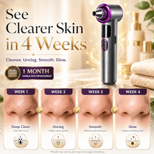 Heated Blackhead Remover Vacuum, Warm Compress Pore Vacuum Cleaner with 3 Suction Levels, LED Display, USB Rechargeable Facial Pore Cleaner Kit, 5 Heads and 4 Stainless Steel Tools